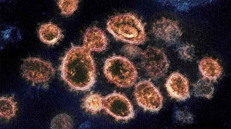 NIH Corona Virus